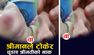 श्रीमानले टोकेर चुडाए श्रीमतीको नाक